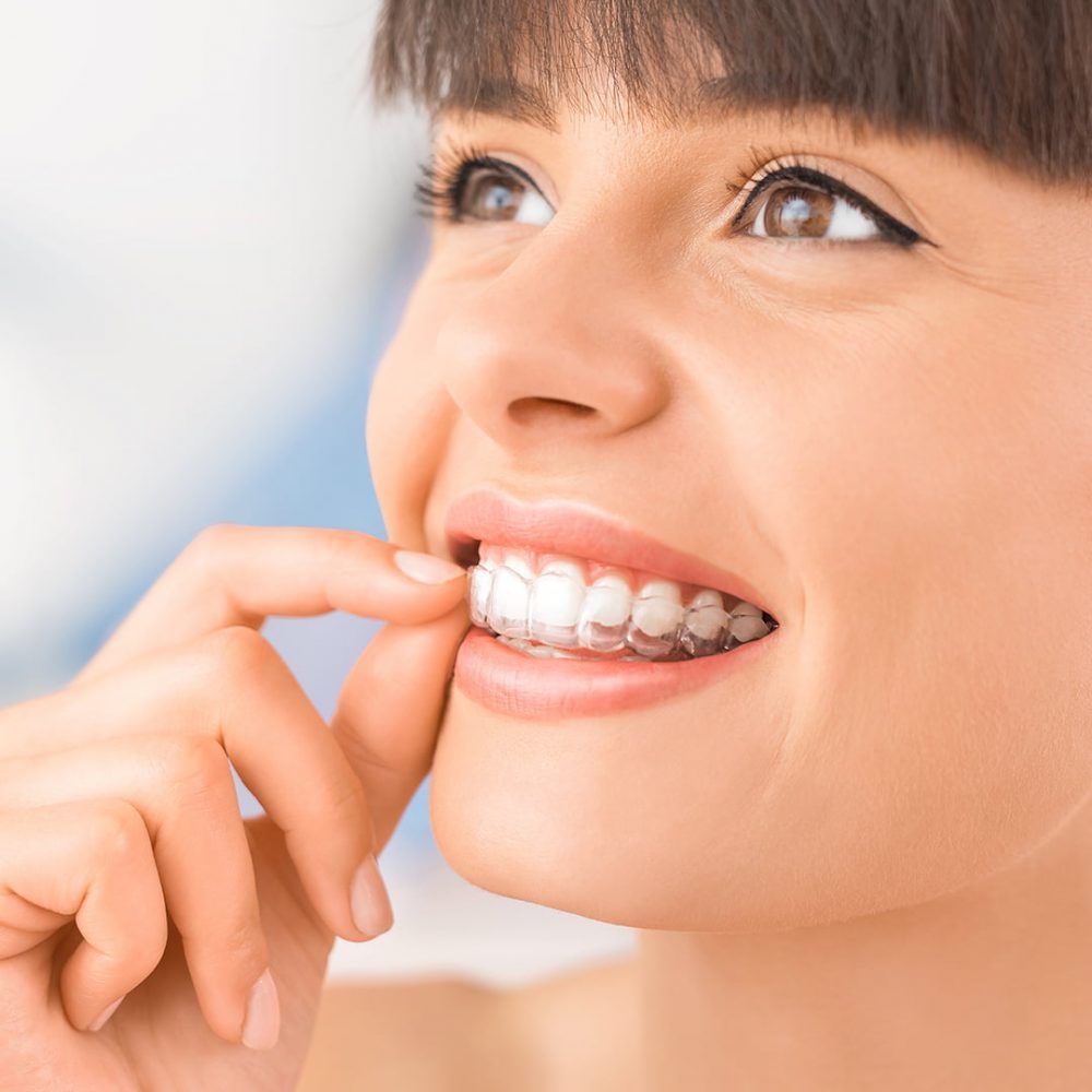 Paciente colocándose un alineador transparente Invisalign