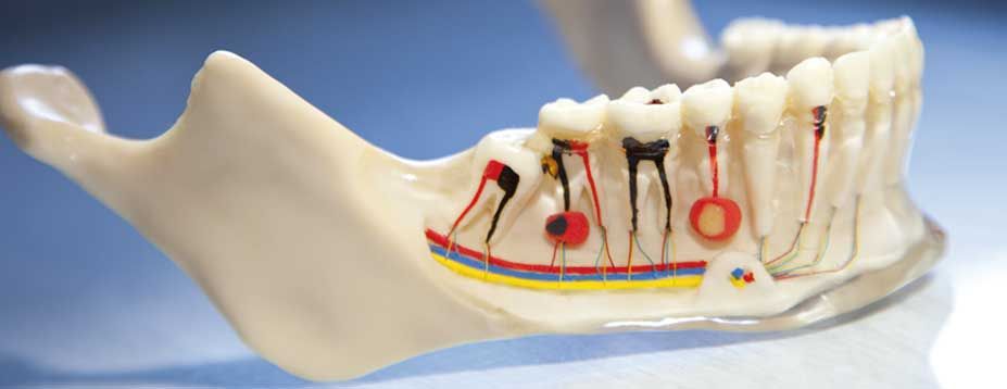 Tratamiento de endodoncia en la clínica dental
