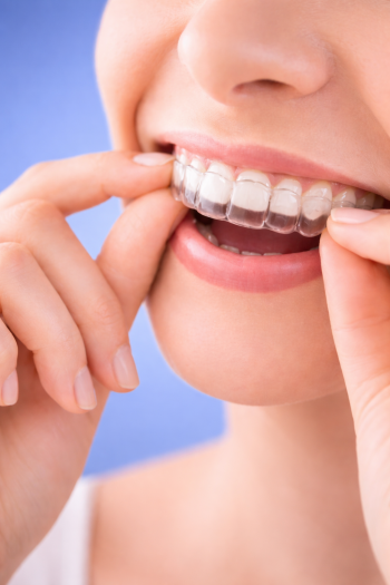 Logotipo de Invisalign