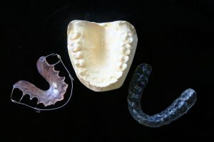 ortodoncia tradicional e invisible